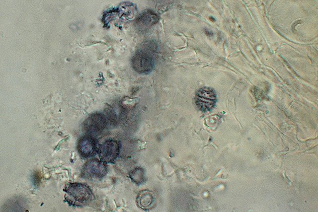 Lactarius spinosulus    Qul. & Le Bret.